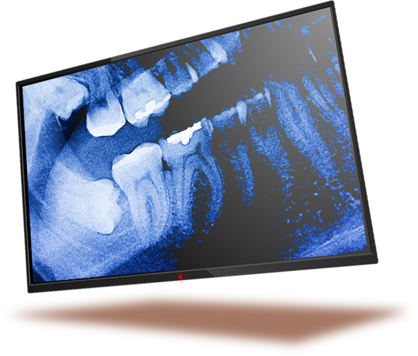 Dental Image Software Curve Dental